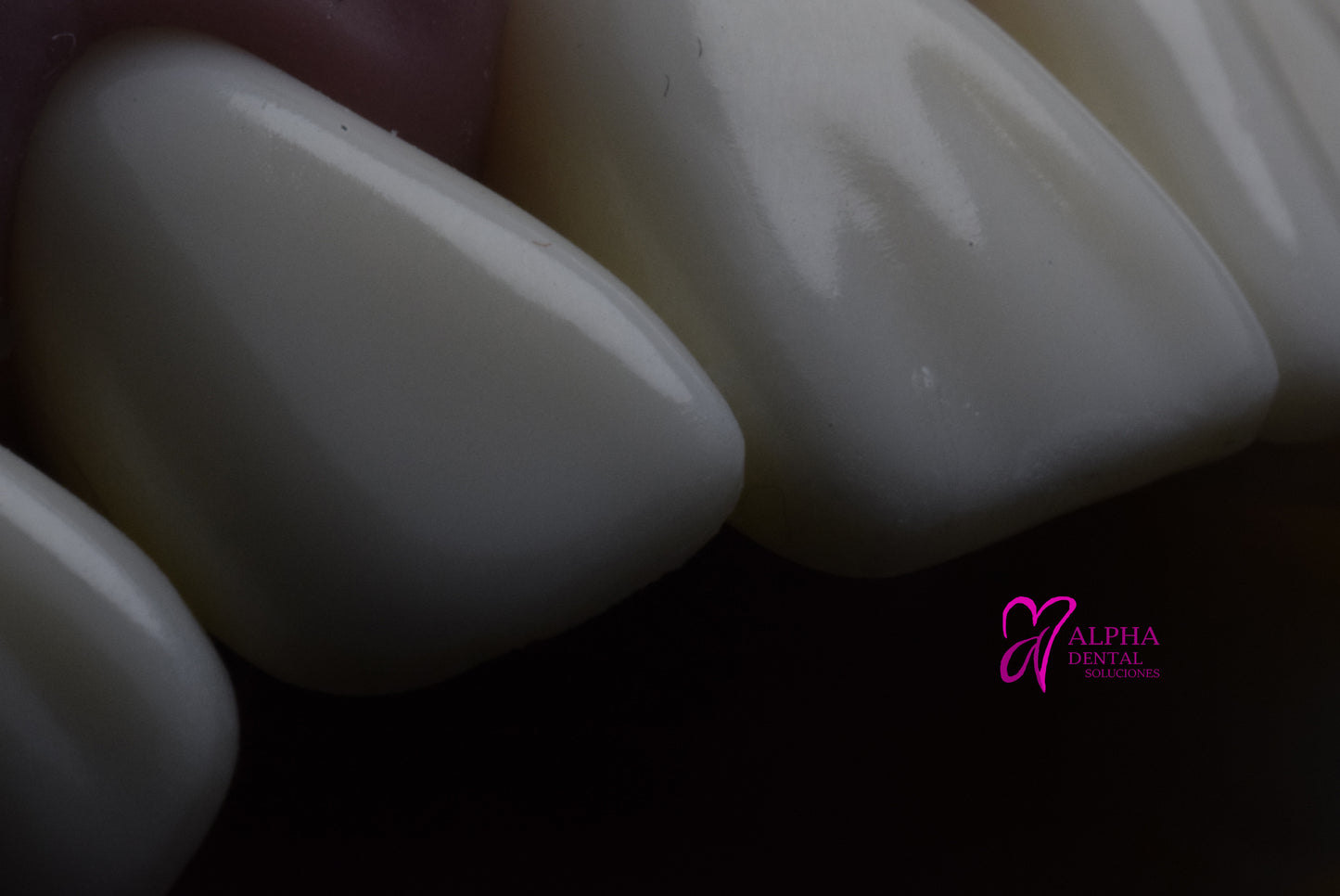 Dientes para Frassaco Set 32 pcs con tornillos