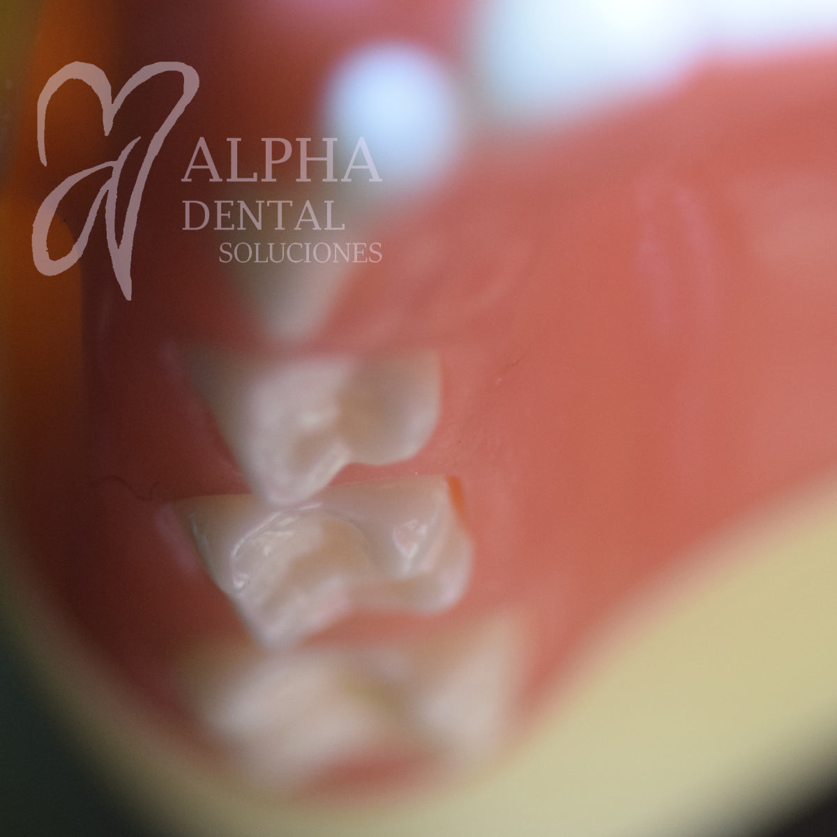 Dientes para Tipodonto Nissiin Infantil set T24