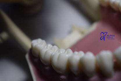 Dientes para Frassaco Set 32 pcs con tornillos - Alpha Dental Soluciones