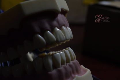 Dientes para Frassaco Set 32 pcs con tornillos - Alpha Dental Soluciones