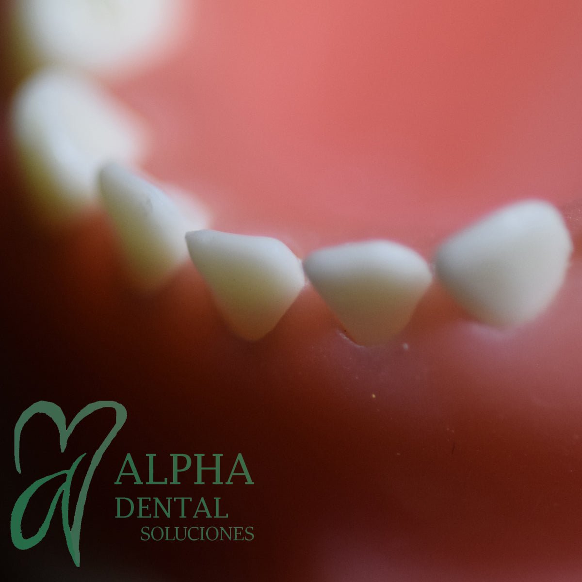 Dientes para Tipodonto Nissiin Infantil set T24 - Alpha Dental Soluciones